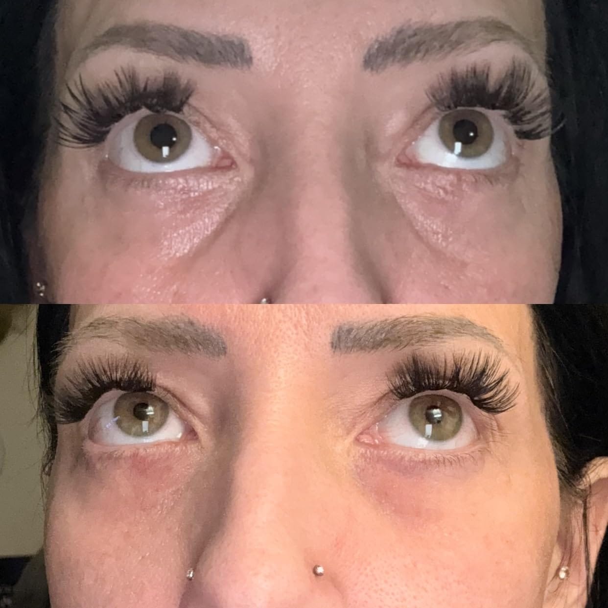 Customer photo review of Rapid Reduction Serum