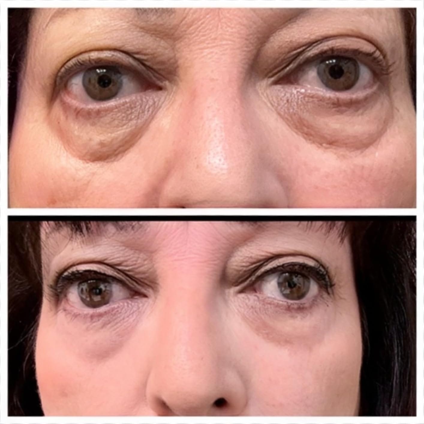 Customer photo review of Rapid Reduction Serum