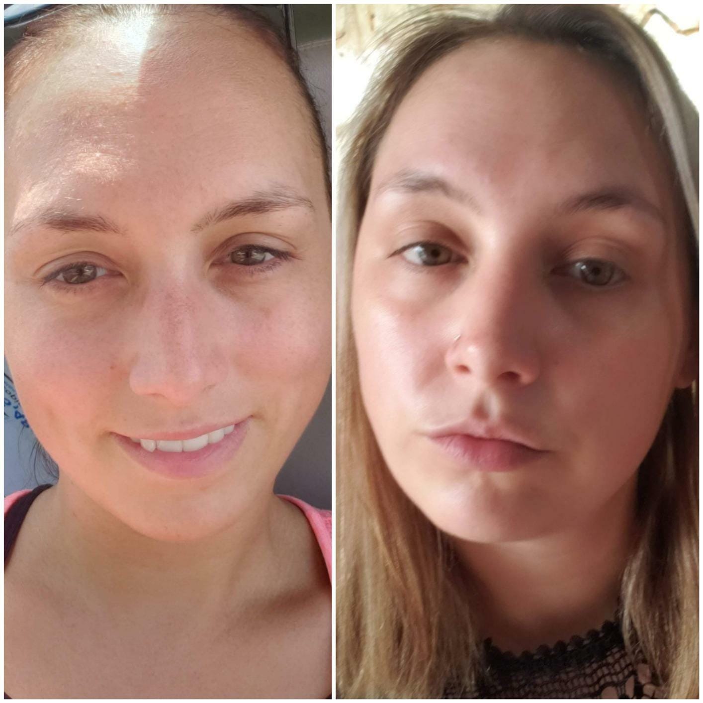 Customer photo review of LEAN Nutraceuticals PhyGLOW Phytoceramides 350mg Capsules, Gluten-Free Yam-Based