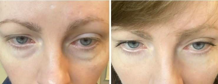 Customer photo review of Rapid Reduction Serum