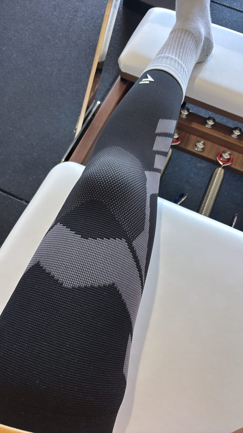 Customer photo review of Compression Sleeves V2 for Knees and Legs