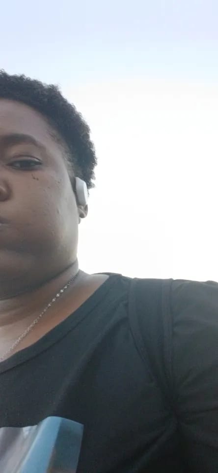 Customer photo review of Aligné Invisible Posture Brace