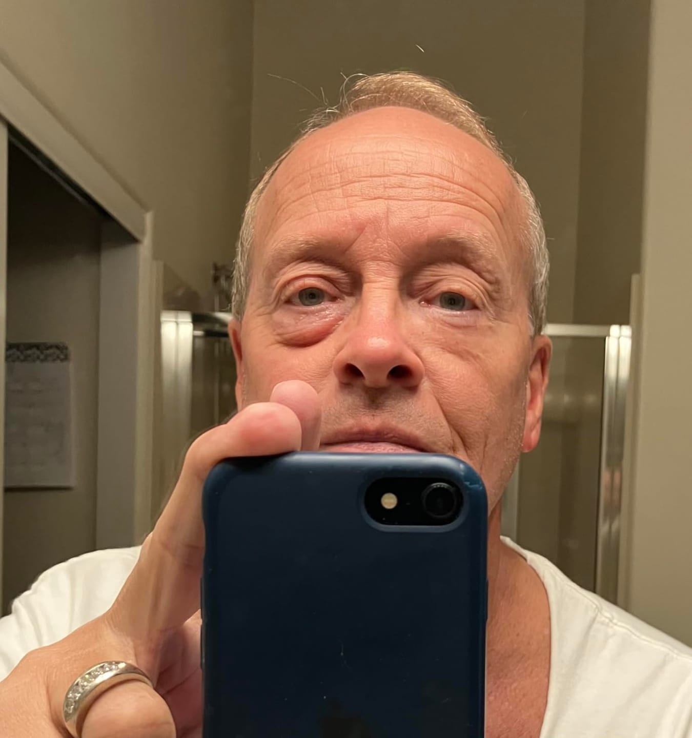 Customer photo review of Rapid Reduction Serum