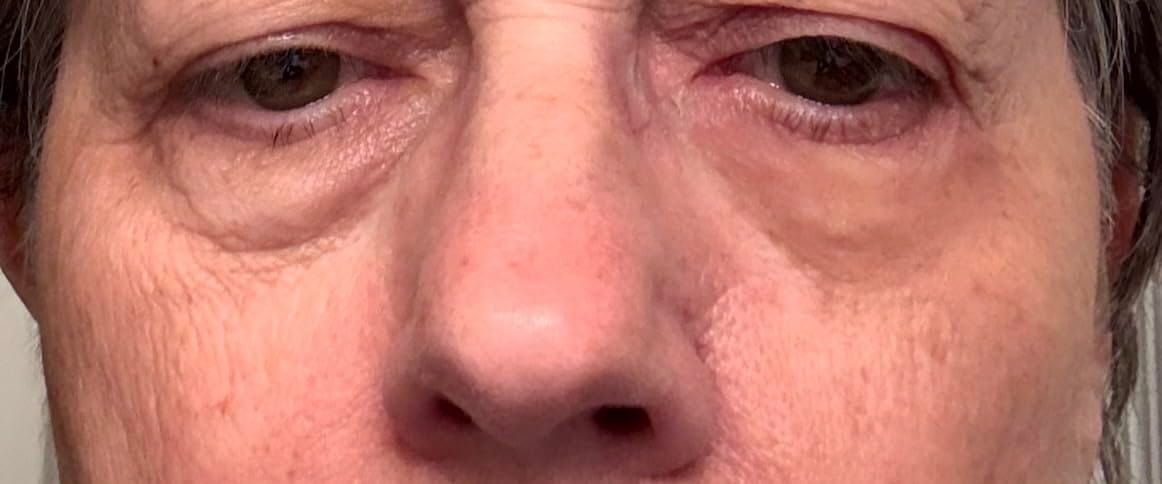 Customer photo review of Rapid Reduction Serum