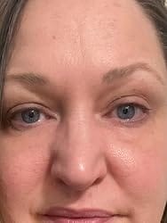 Customer photo review of Rapid Reduction Serum
