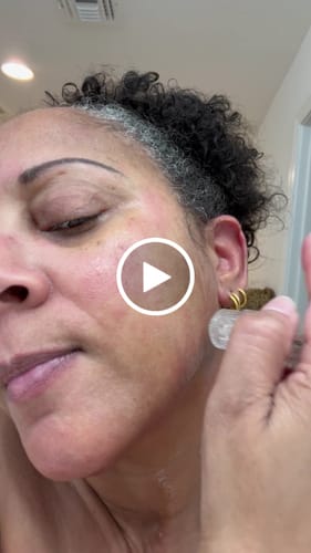 Customer video review of 1 Month Supply of Seranova Microneedling Infusion System™