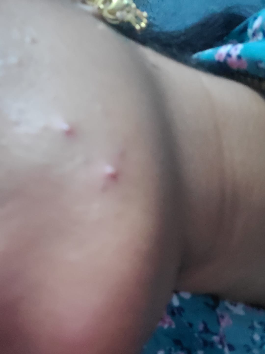 Customer photo review of Ujvala Skin Brightening Moisturizer