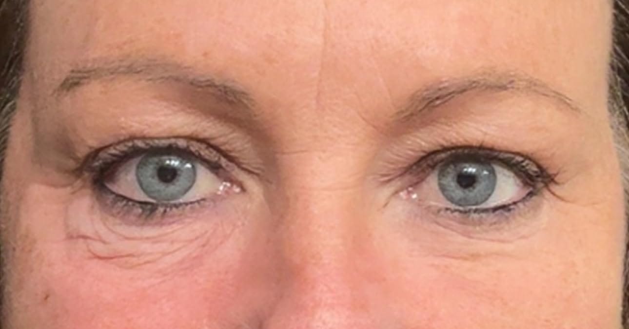 Customer photo review of Rapid Reduction Serum