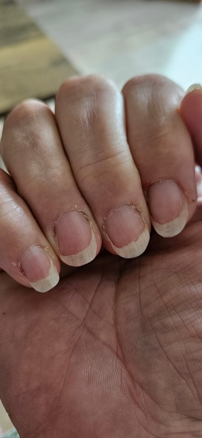 Customer photo review of 30 Days Of Age Defying Multi-Collagen