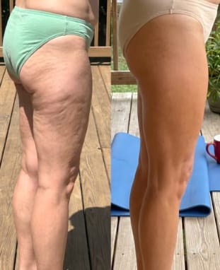 Customer photo review of Aceite Corporal Reafirmante