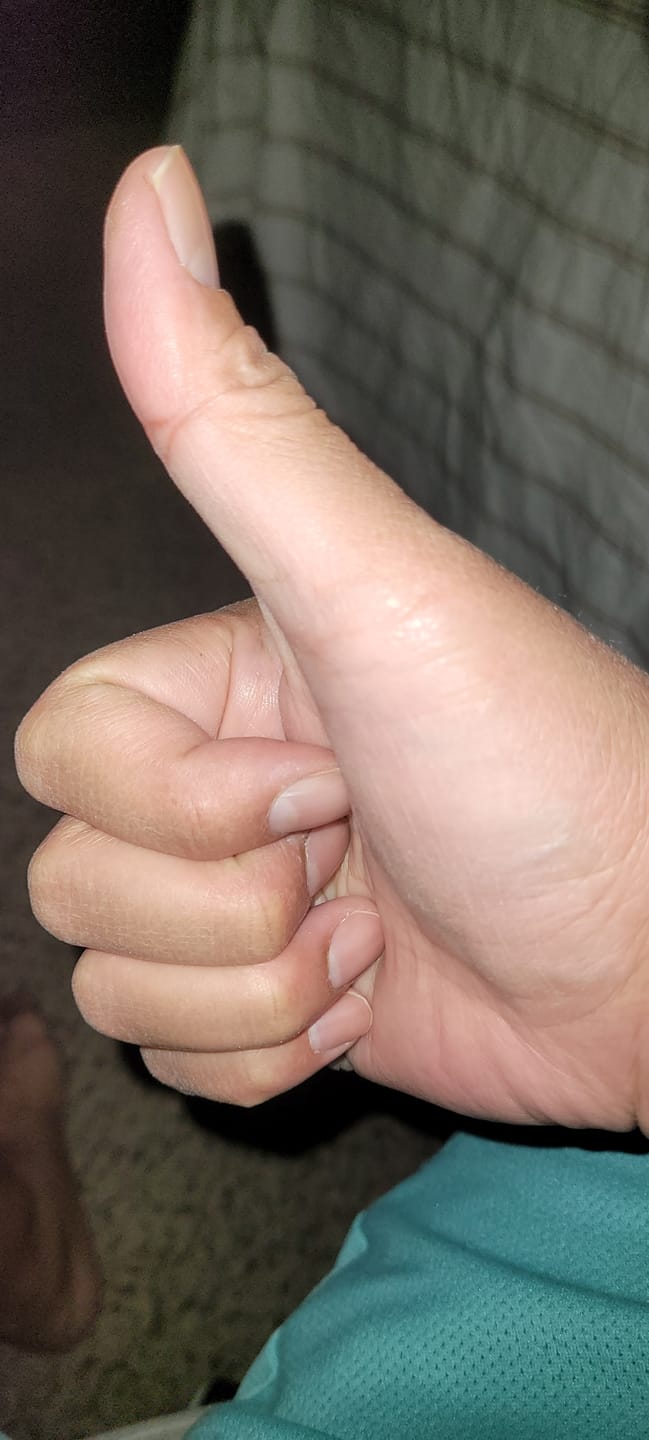 Customer photo review of Sweet ZZ - Minis - 14 Grams - Indica