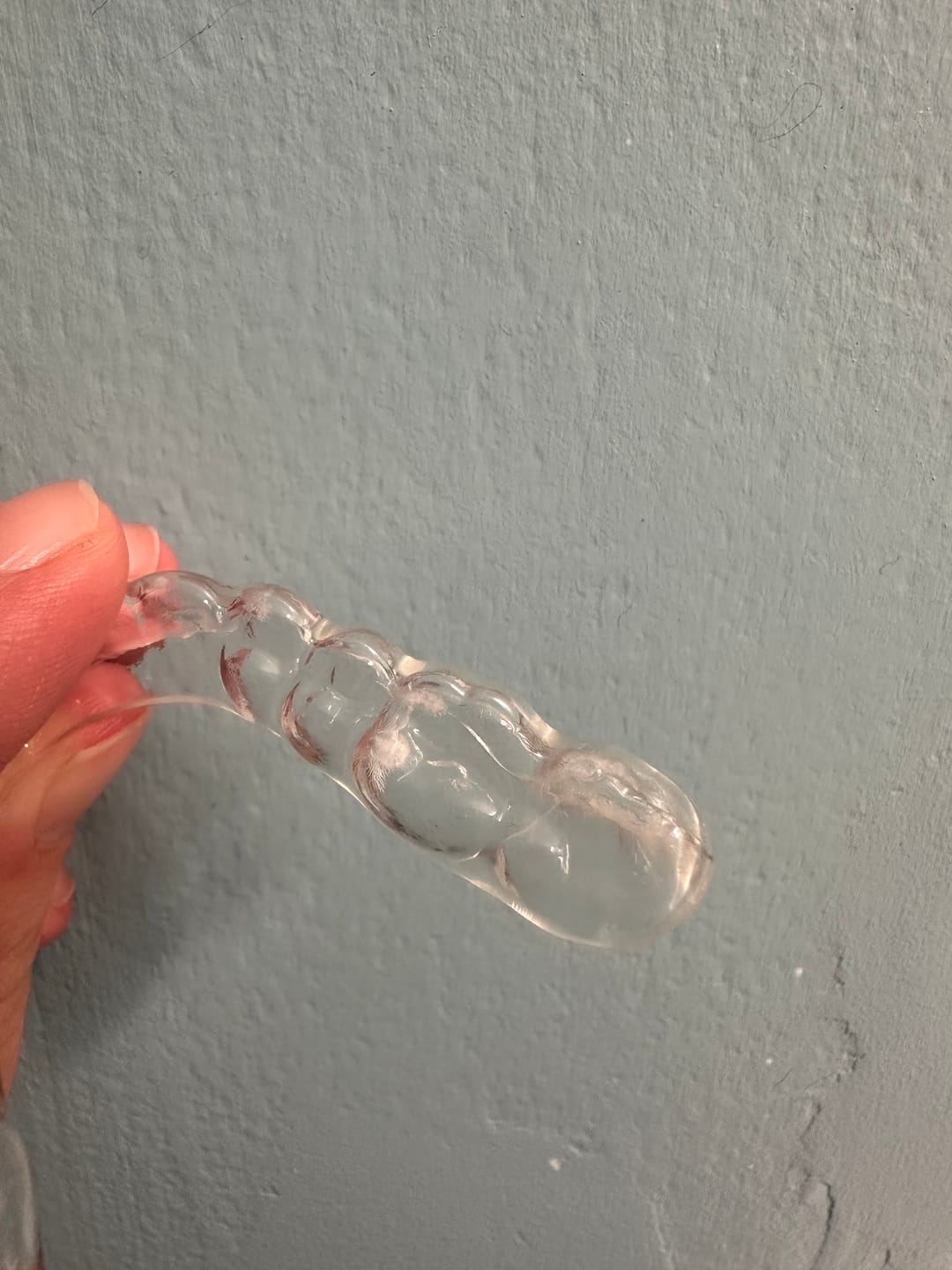 Customer photo review of Custom Clear Removable Retainers