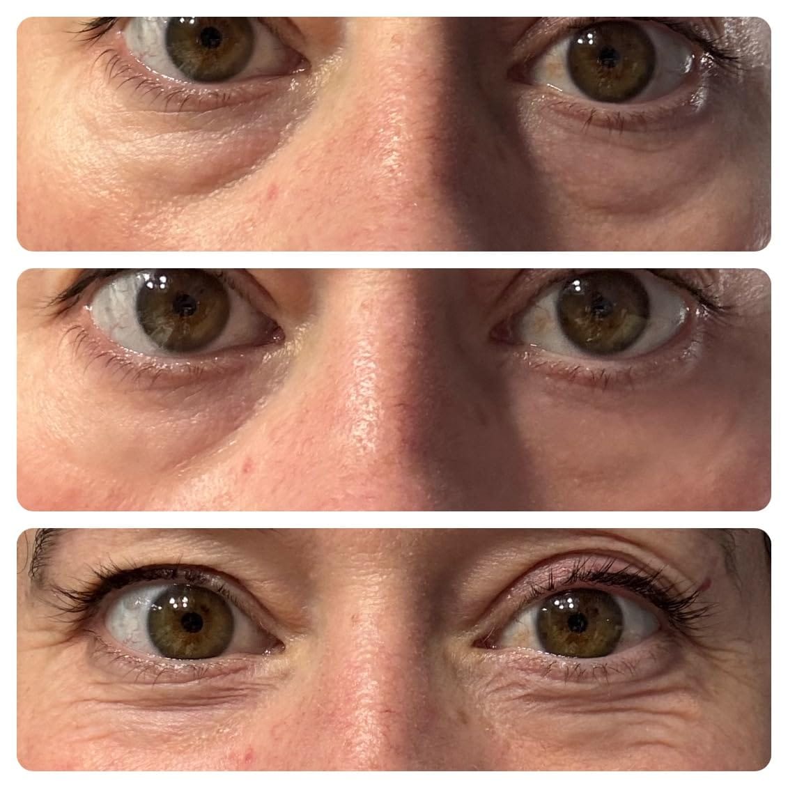 Customer photo review of Rapid Reduction Serum