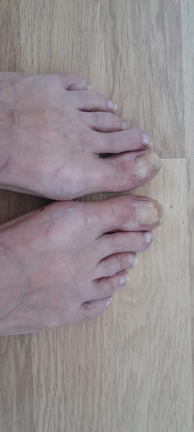 Customer photo review of Fungal Freedom