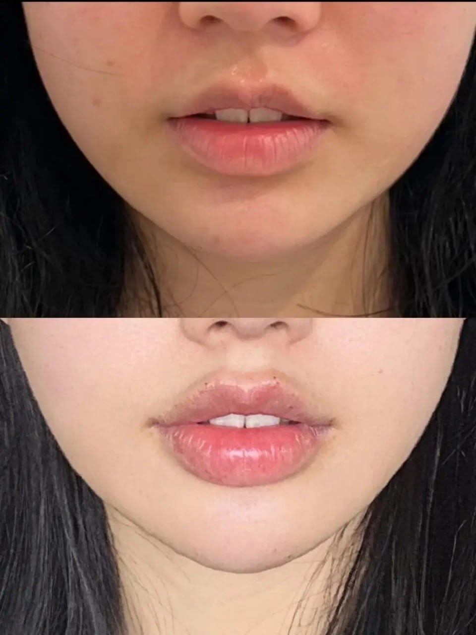 Customer photo review of Plump Tape · Cinta Labial Voluminizadora de Noche