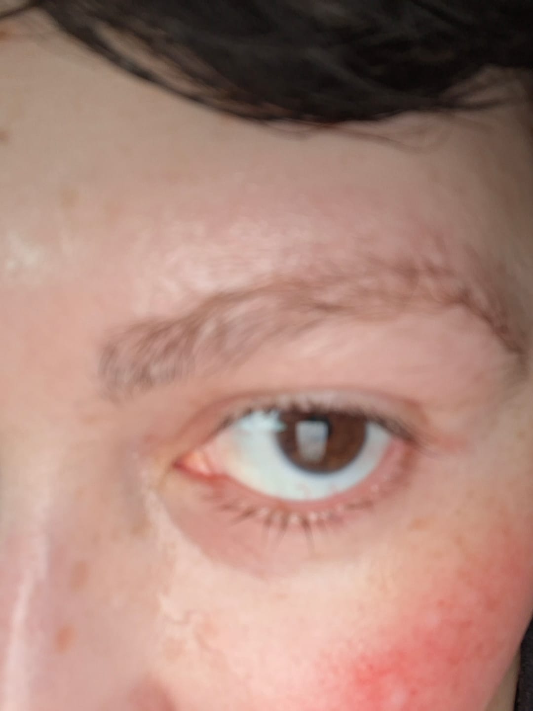 Customer photo review of ¡Nuevo! Contorno de Ojos Antiage 15ml