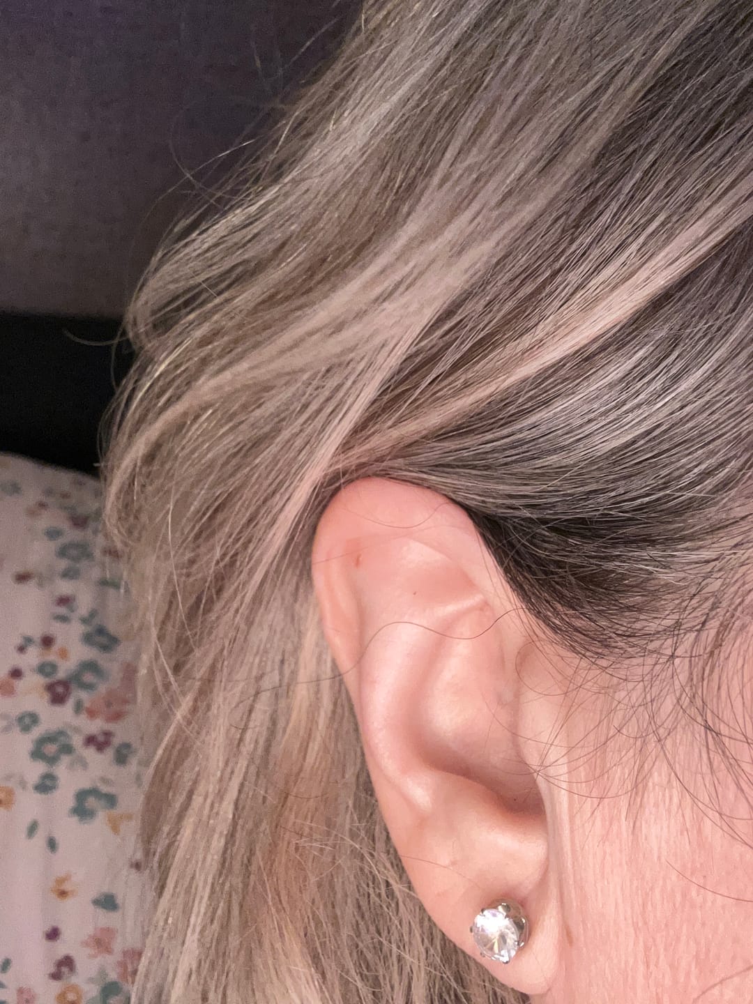 Customer photo review of Faux Pearl Studs Hypoallergenic Earrings for Sensitive Ears with Plastic Posts