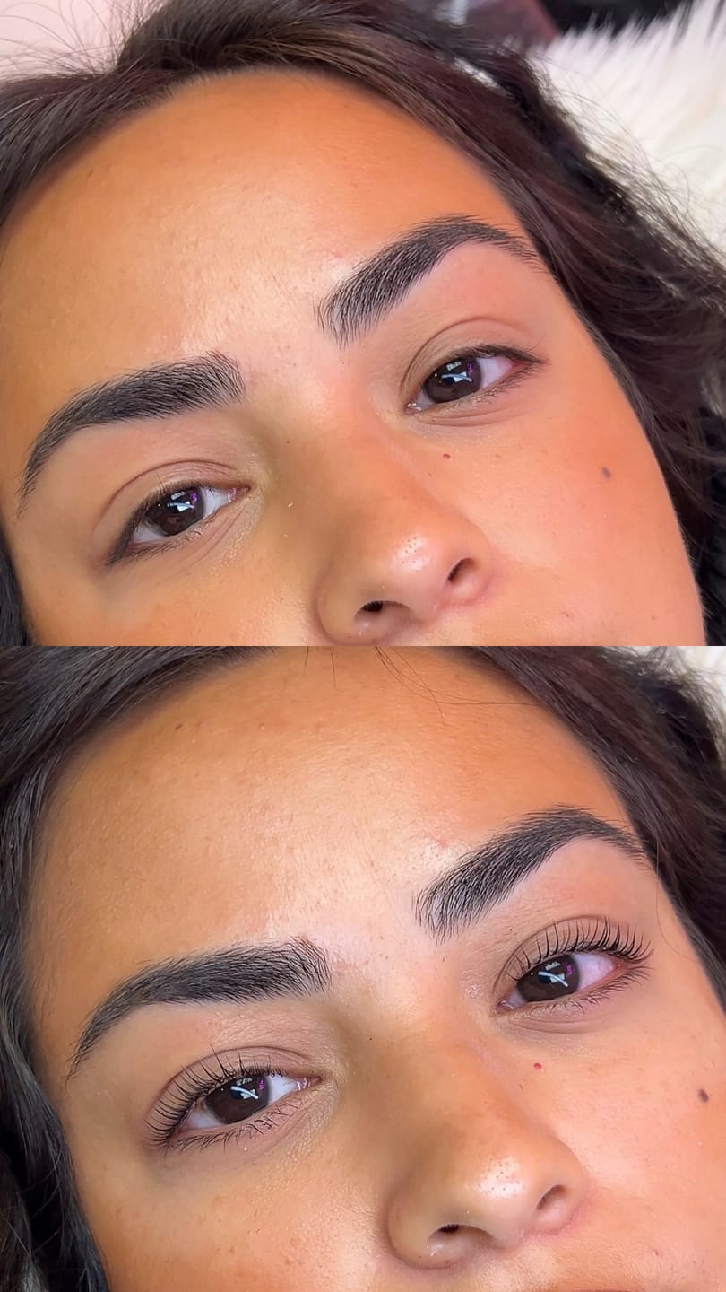 Customer photo review of BKO Lift System (3-Step Lamination)