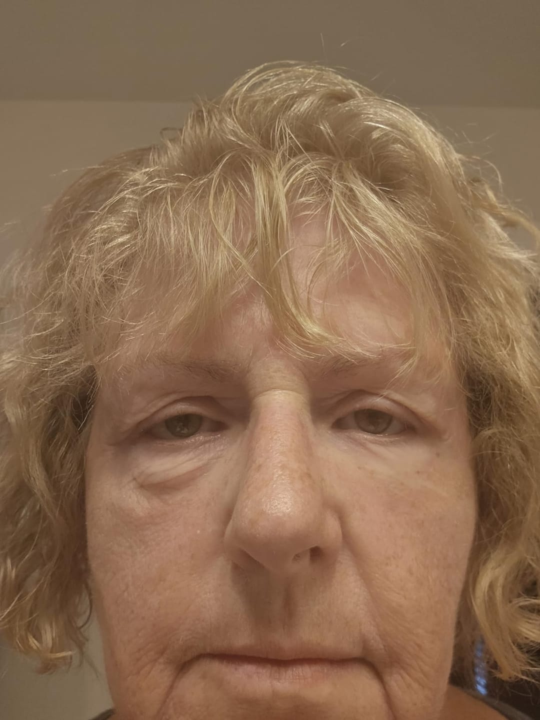 Customer photo review of Rapid Reduction Serum