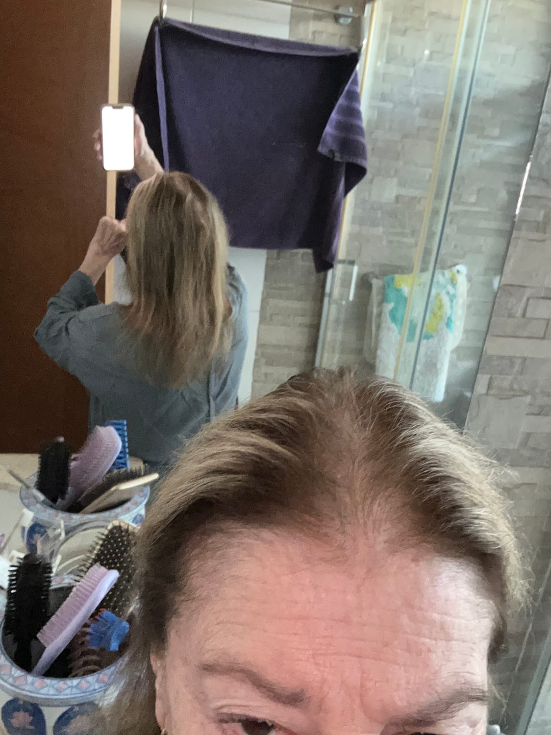 Customer photo review of Pack Anticaída de Cabello para 1 Mes