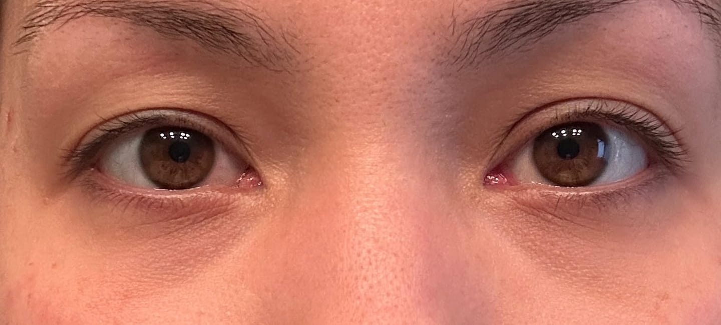 Customer photo review of Rapid Reduction Serum