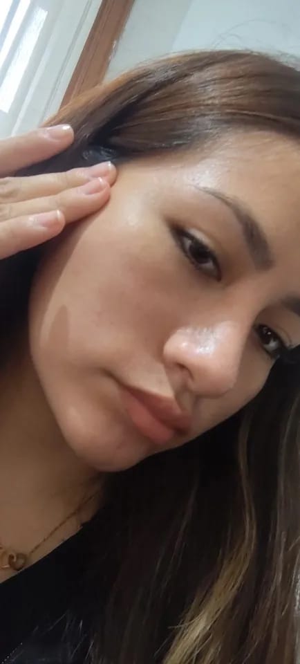 Customer photo review of FaceGlow™ Bio-Collagen Peel-Off Mask