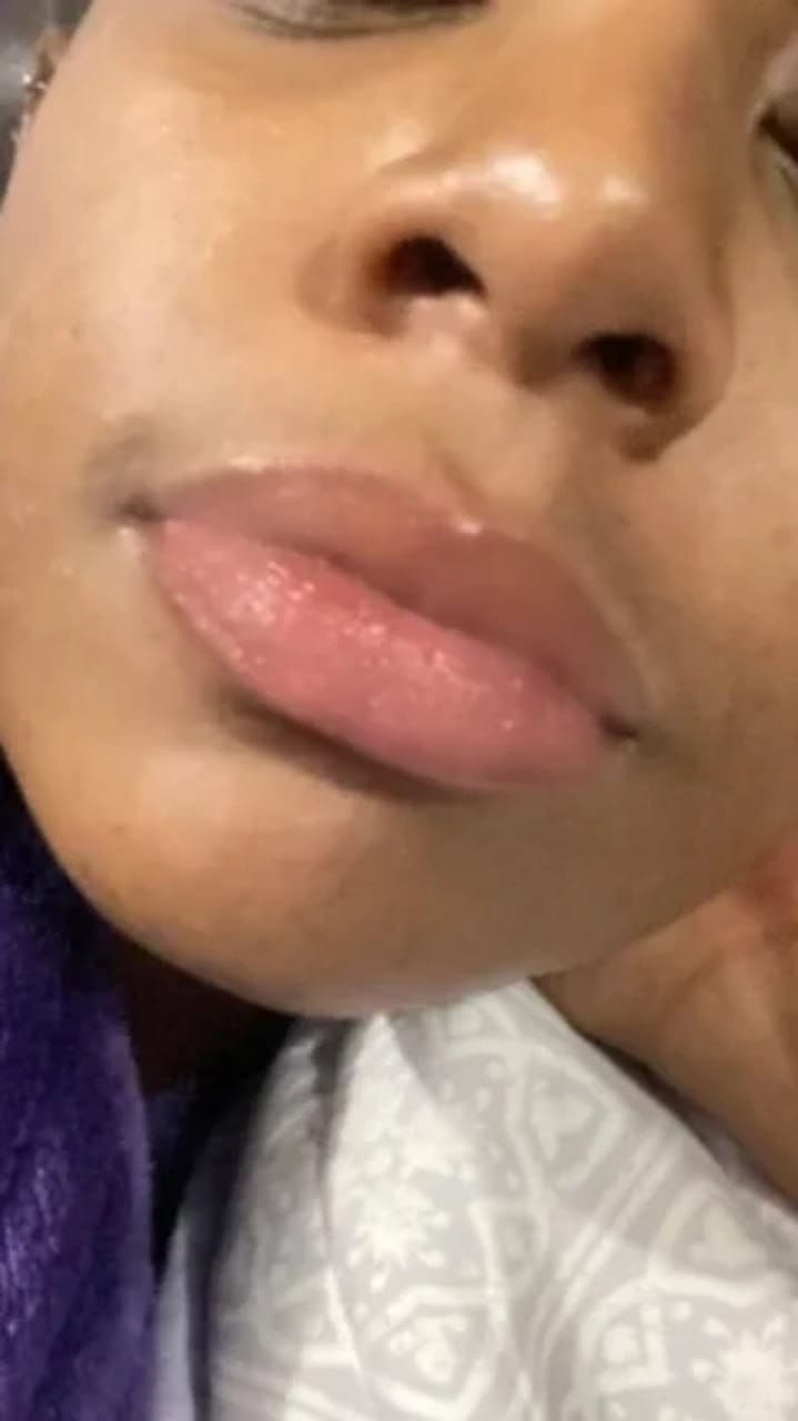 Customer photo review of Plump Tape · Cinta Labial Voluminizadora de Noche
