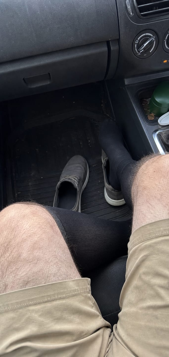 Customer photo review of Compression Socks for Men Everyday