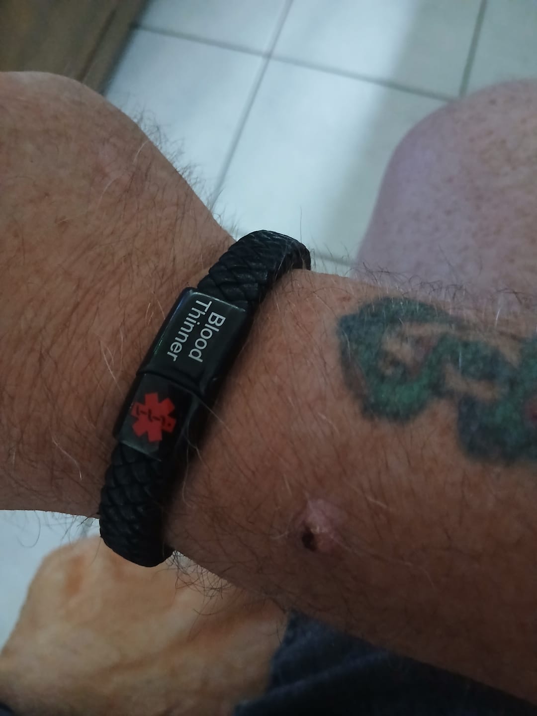 Customer photo review of Medische Waarschuwingsarmband