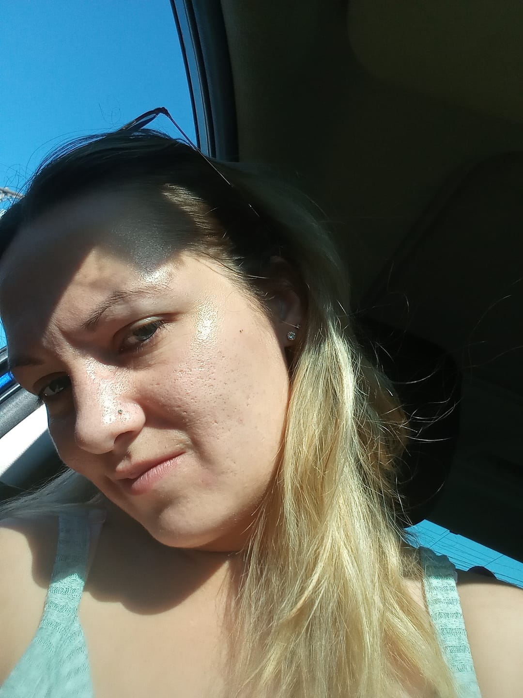 Customer photo review of Dermatologic Acne Scar Repair Stick™