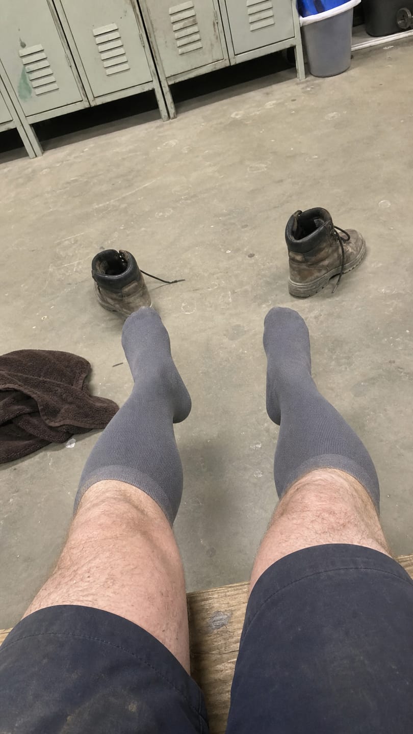 Customer photo review of Compression Socks for Men Everyday