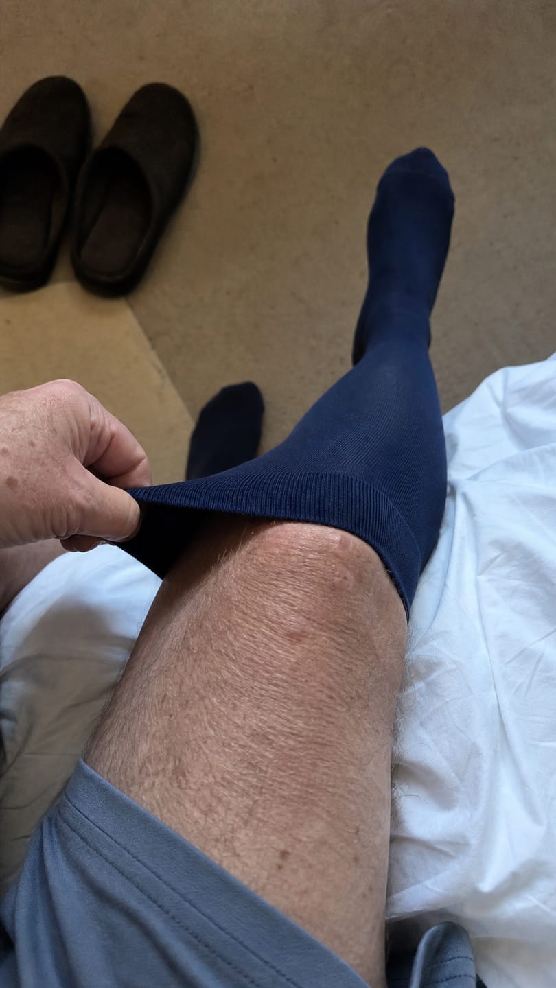 Customer photo review of Compression Socks for Men Everyday