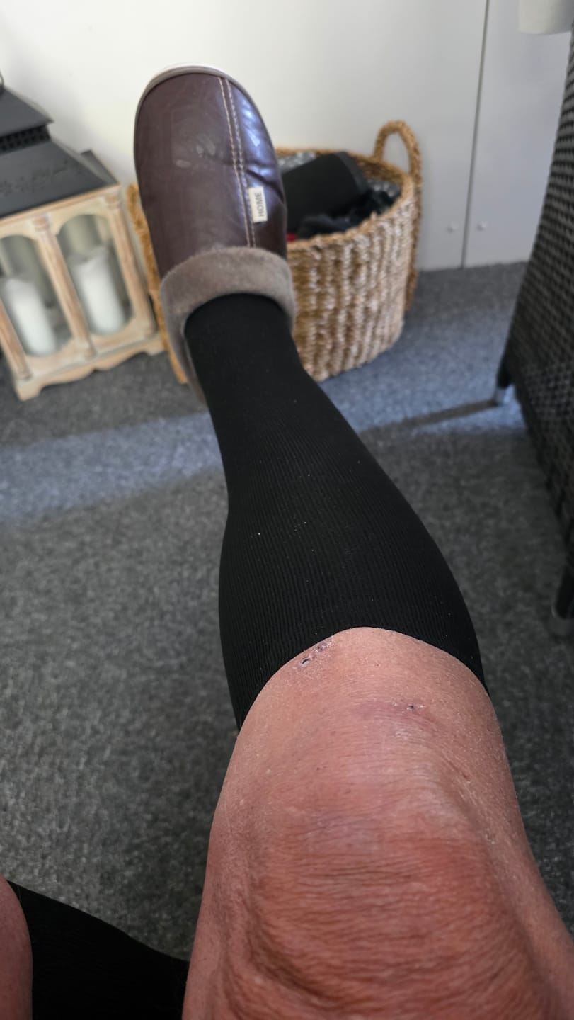 Customer photo review of FlowSocks™ - Støttesokker