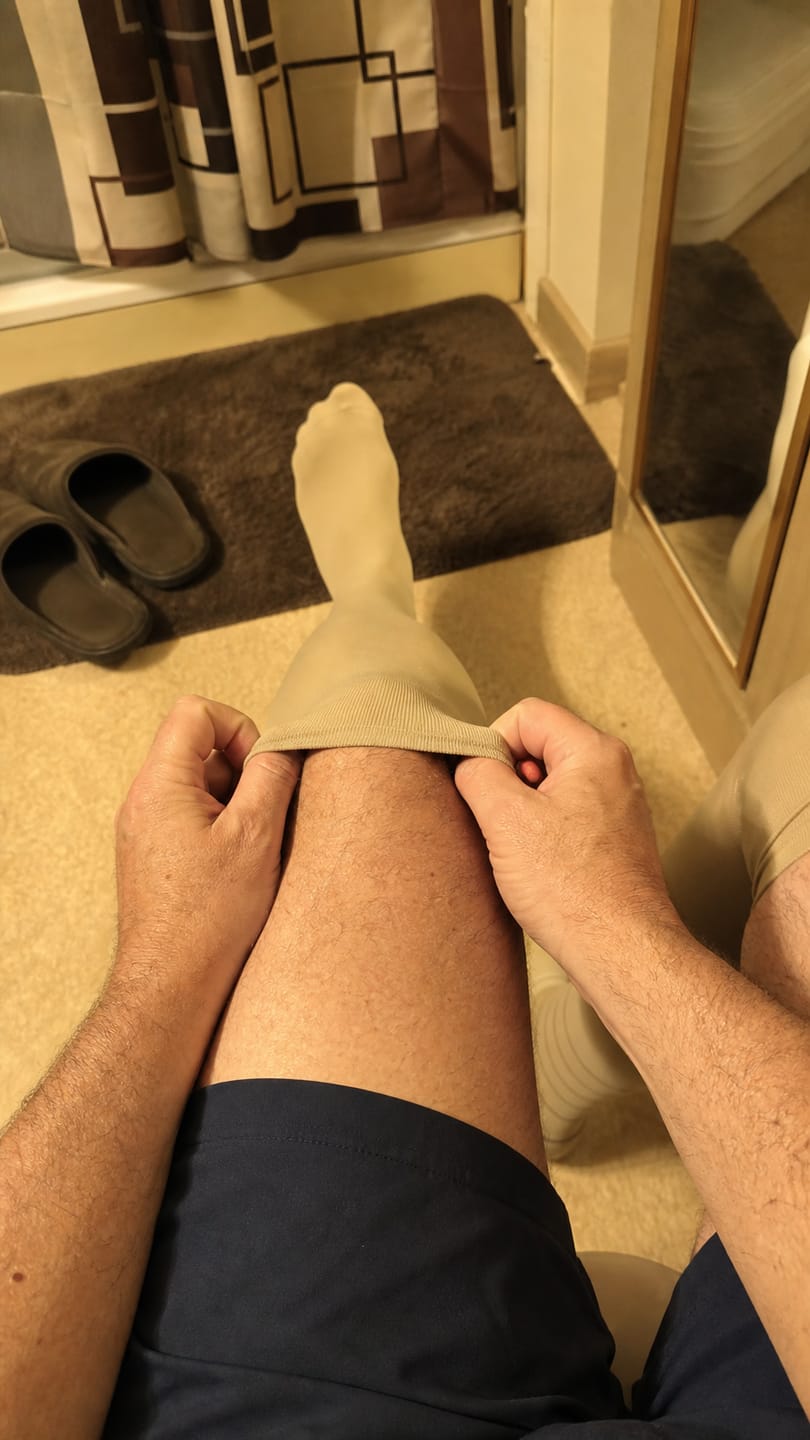 Customer photo review of Compression Socks for Men Everyday