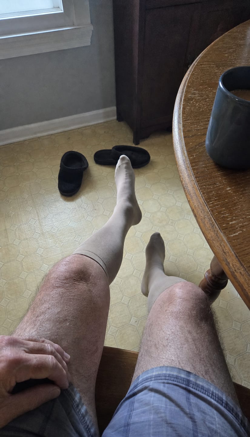 Customer photo review of Compression Socks for Men Everyday