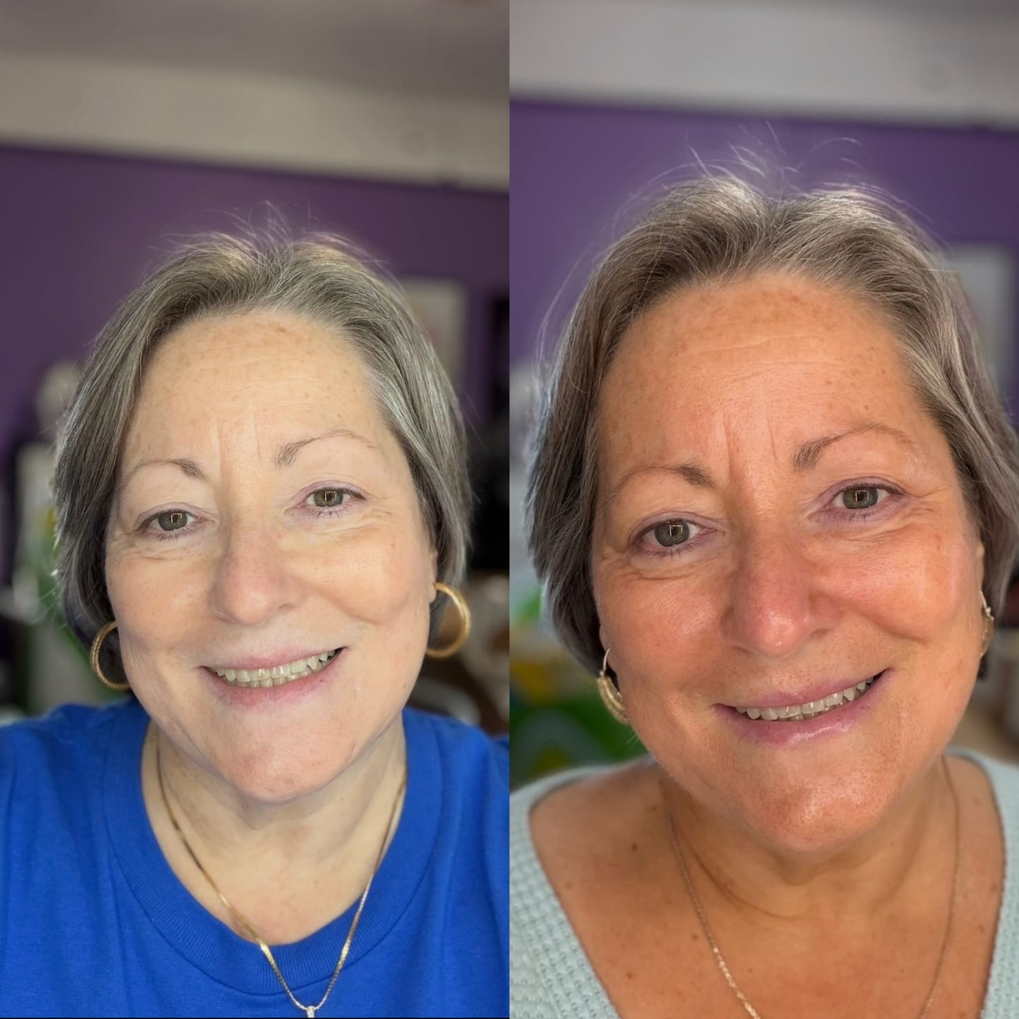 Customer photo review of Sunny Girl Face Tanning Mist