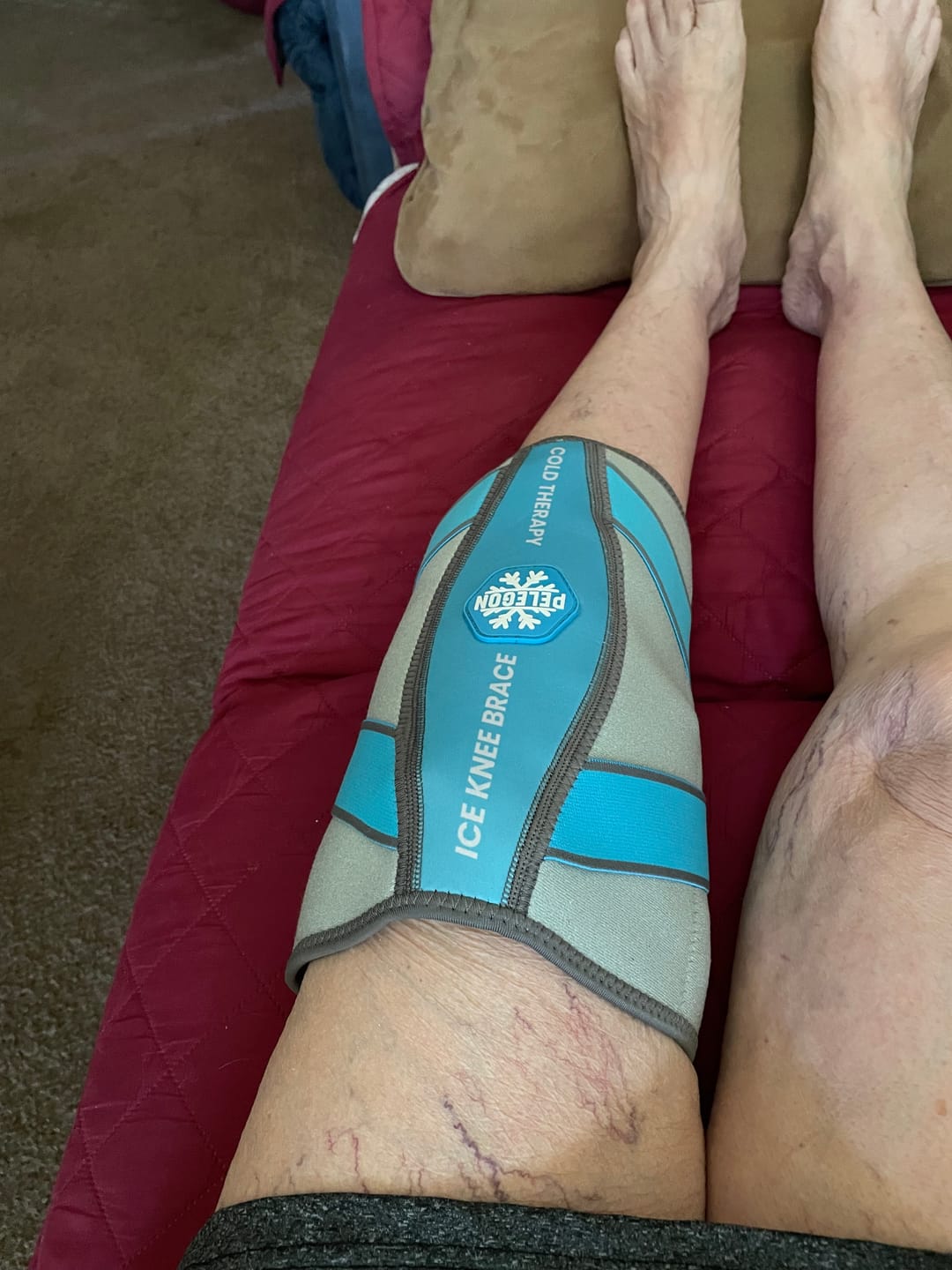 Customer photo review of Ice Pack For Knee