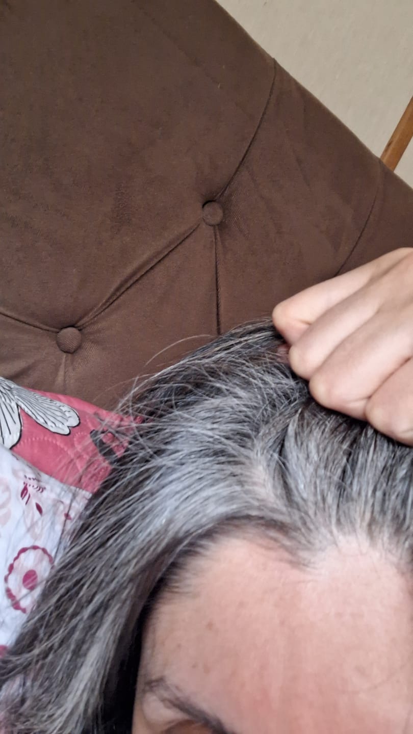 Customer photo review of Tratamiento Anticaída x 1 Mes + Gomitas de Biotina