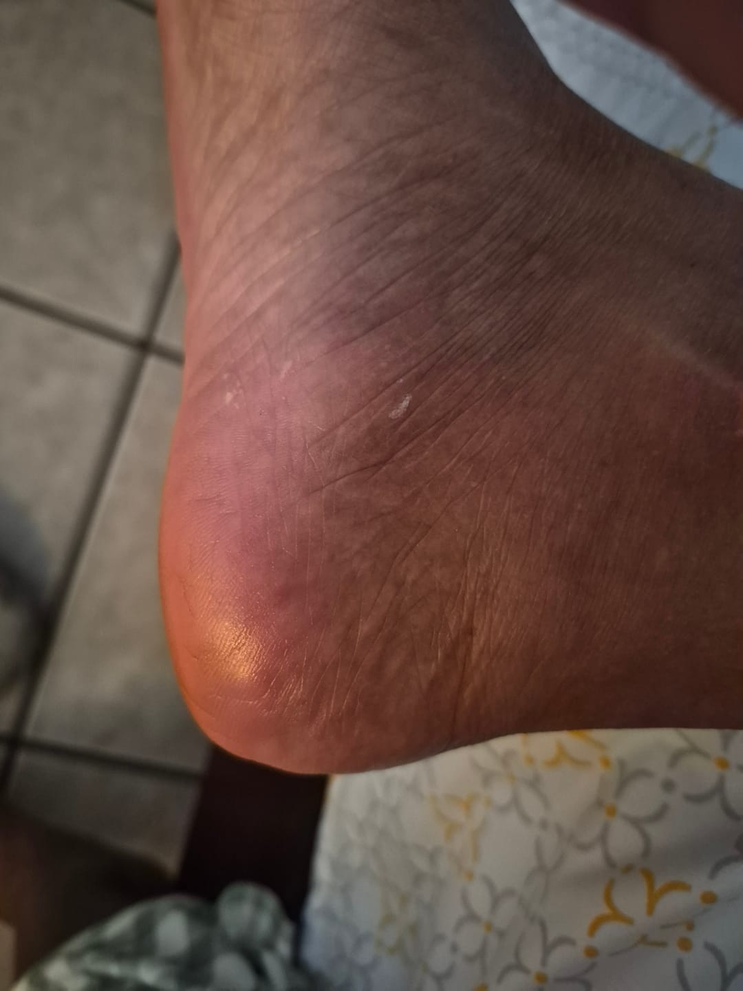 Customer photo review of Foot Balm