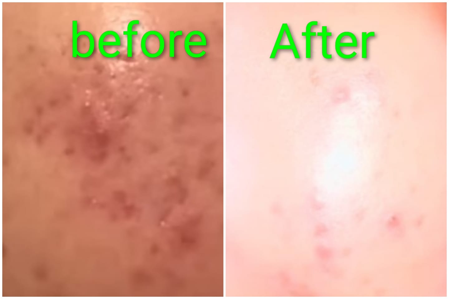 Customer photo review of MandelAC Facewash