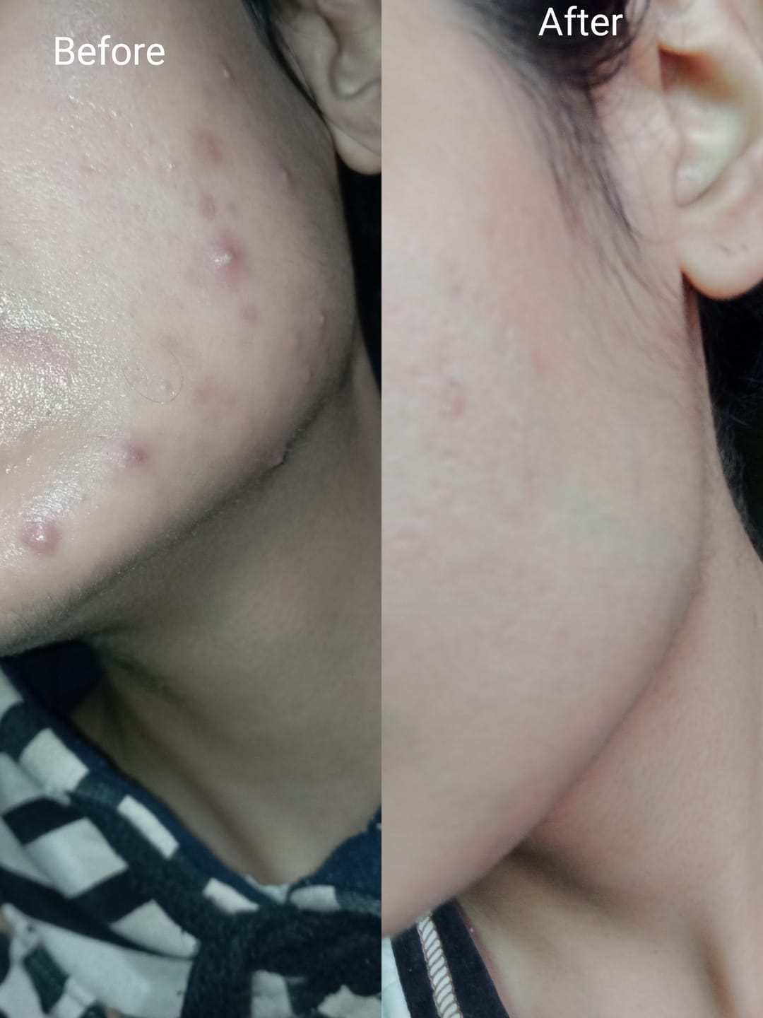 Customer photo review of MandelAC Serum