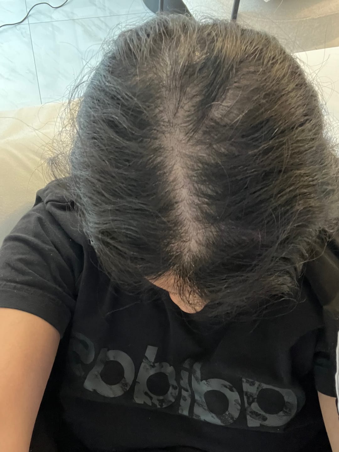 Customer photo review of Custom Hair Growth Treatment