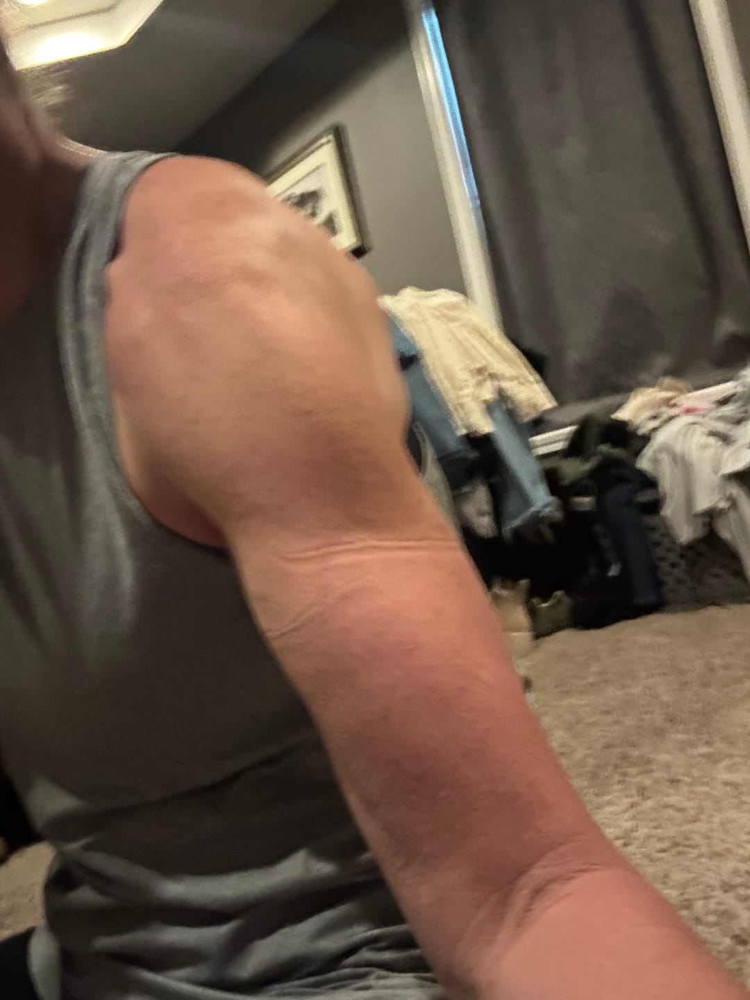 Customer photo review of Additional Band Pairs 2pcs