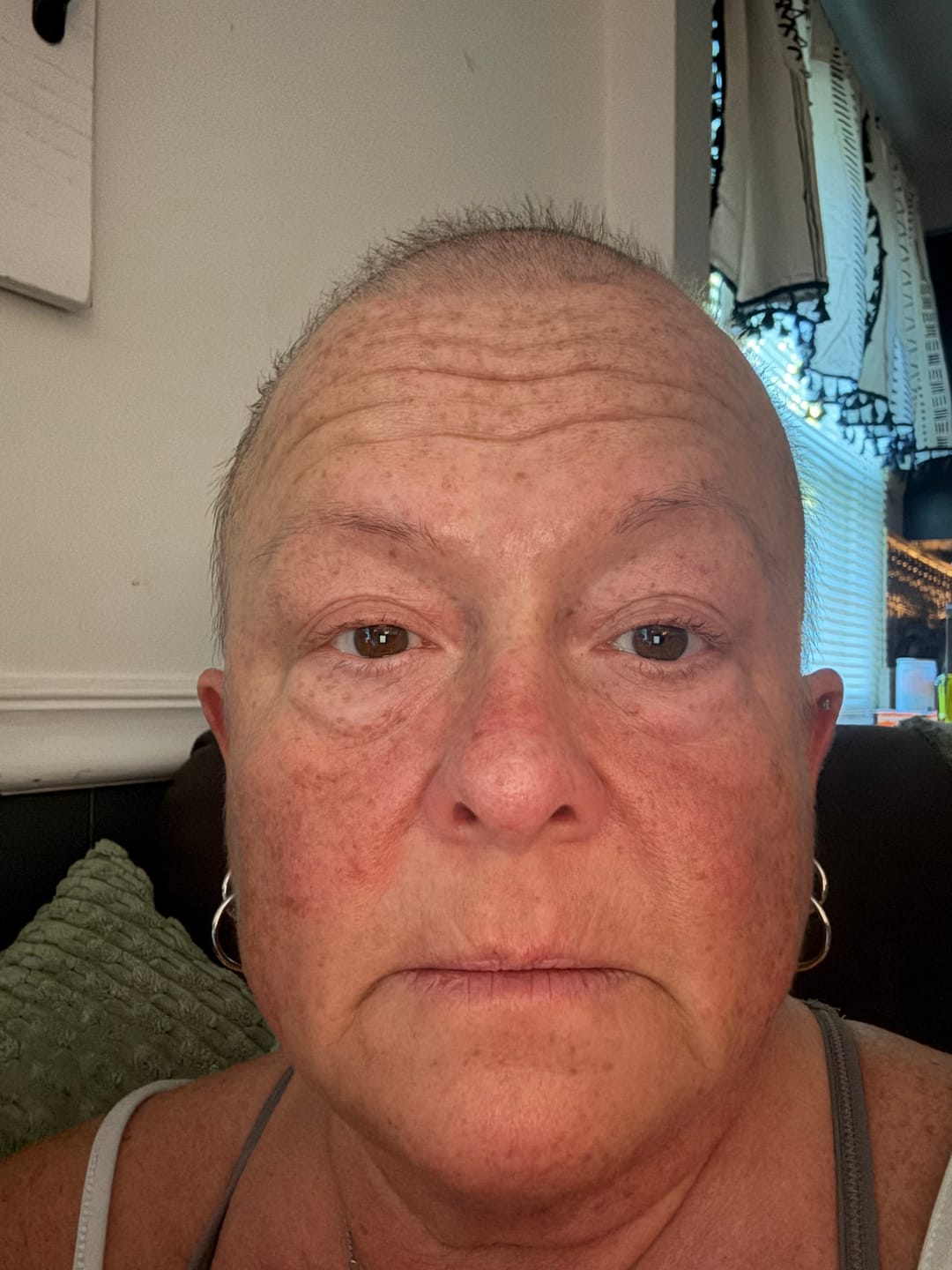 Customer photo review of Chemo Hair and Scalp Care Bundle