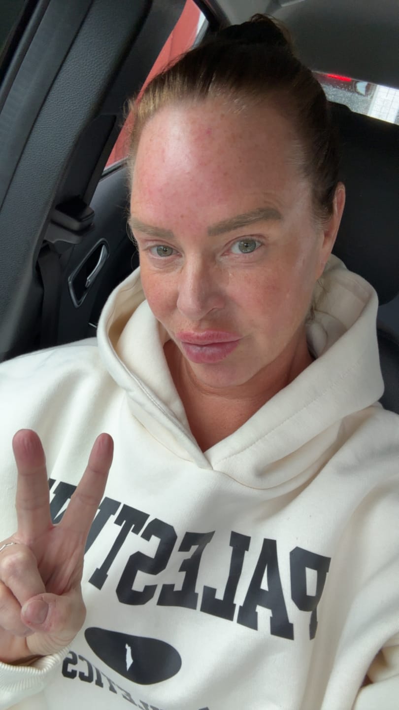 Customer photo review of ATHLETICS Oversized Hoodie