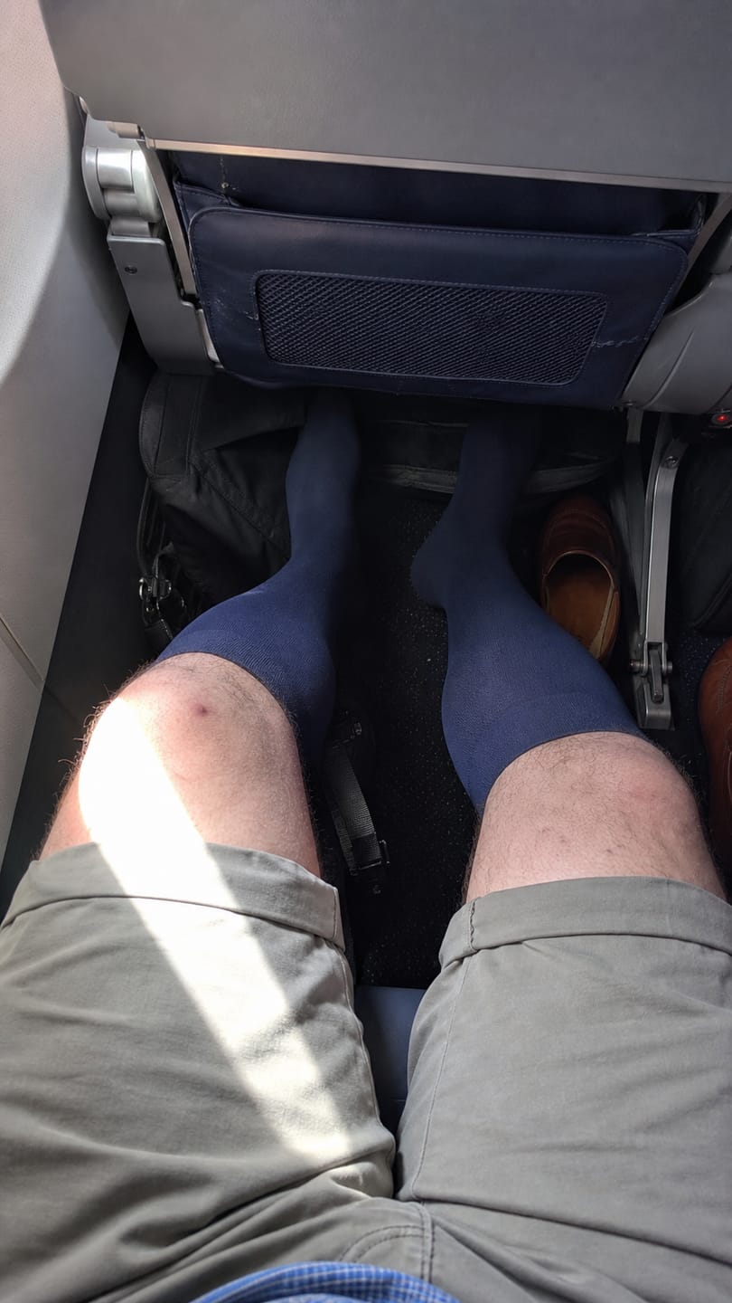 Customer photo review of Compression Socks for Men Everyday