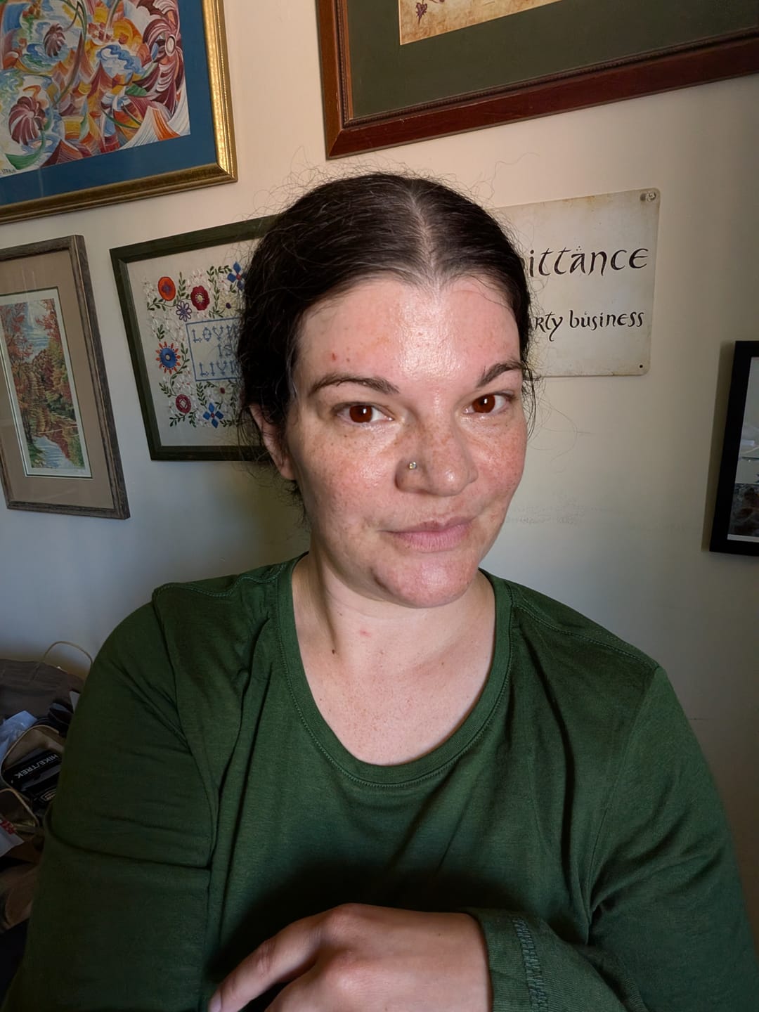Customer photo review of Eyeling Custom Lens – 1 Month