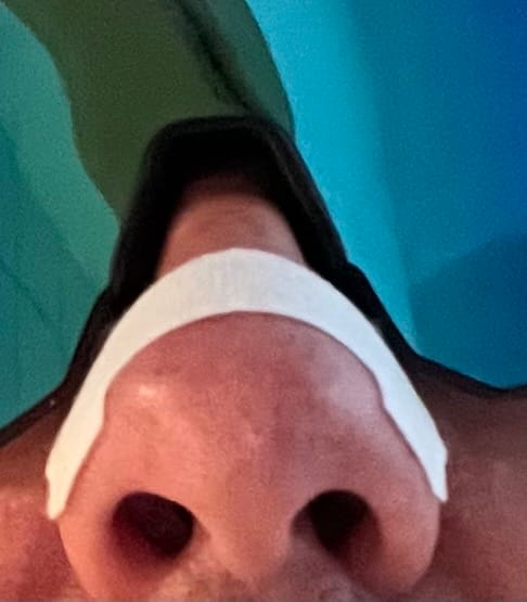 Customer photo review of White Nasal Strips