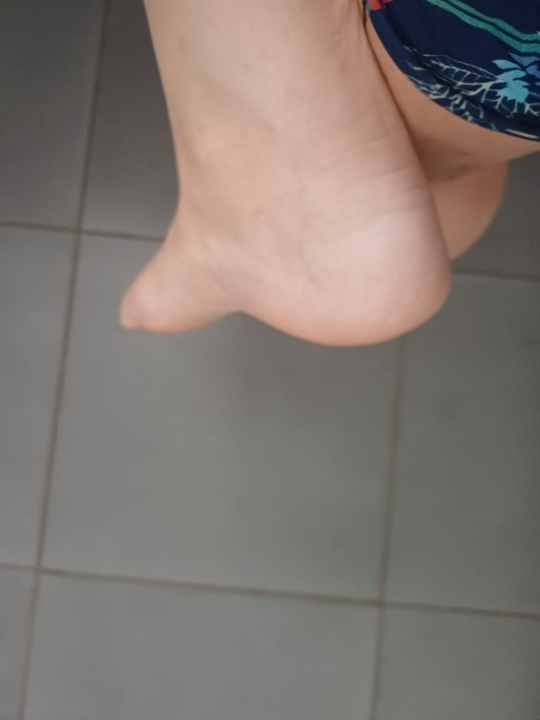 Customer photo review of ✨ HoneyGlow™ – Kit Beauté Pieds