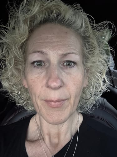 Reviewer's face showing skin texture after using The Micro Infusion System.